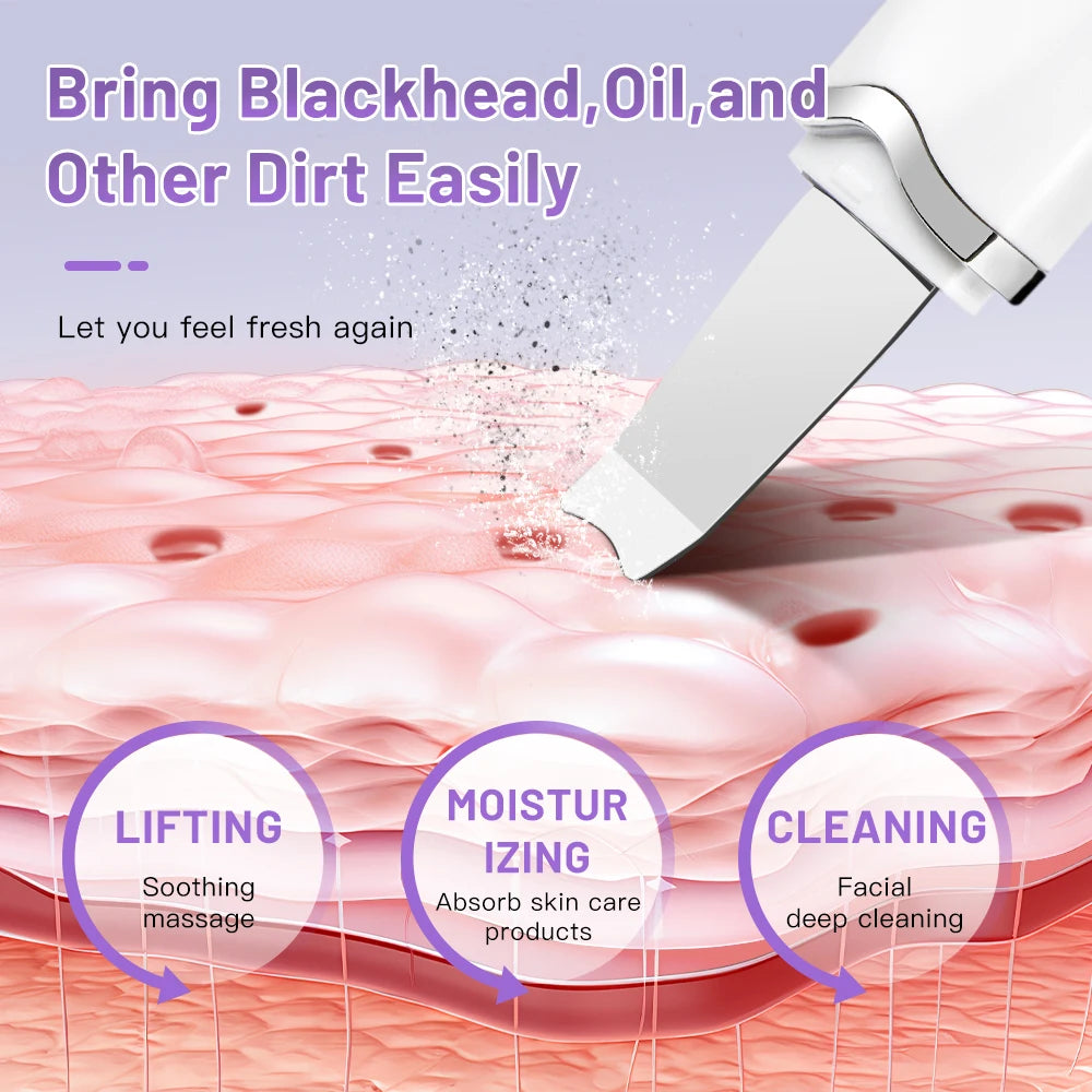Ultrasonic Skin Scrubber – Deep Cleansing & Facial Lifting Tool