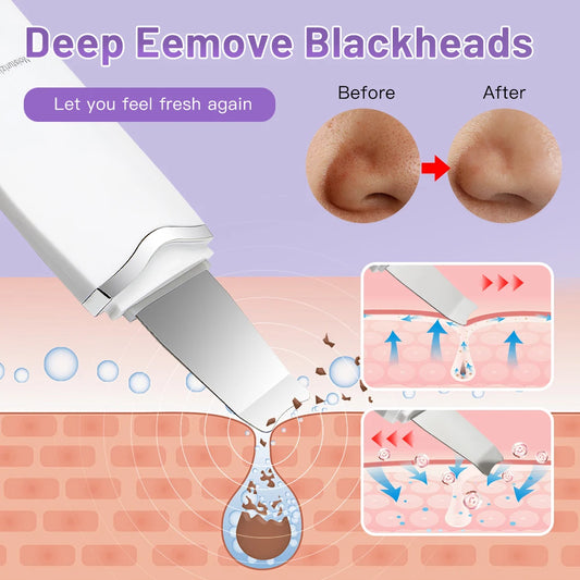 Ultrasonic Skin Scrubber – Deep Cleansing & Facial Lifting Tool