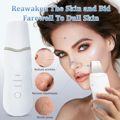 Ultrasonic Skin Scrubber – Deep Cleansing & Facial Lifting Tool