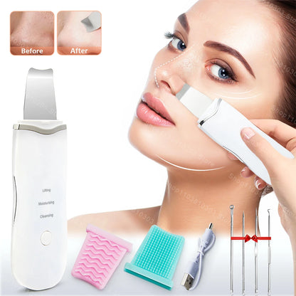 Ultrasonic Skin Scrubber – Deep Cleansing & Facial Lifting Tool