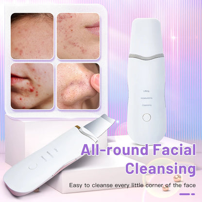 Ultrasonic Skin Scrubber – Deep Cleansing & Facial Lifting Tool