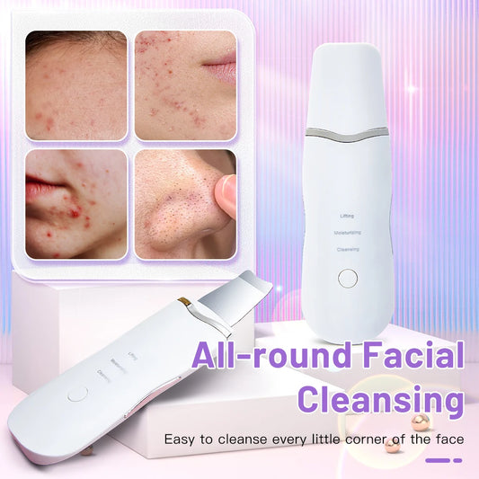 Ultrasonic Skin Scrubber – Deep Cleansing & Facial Lifting Tool